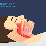 手绘医疗肺部肺炎治疗免扣元素 肺部肺树素材