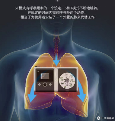 瑞迈特呼吸机,夜间打鼾者的福音!