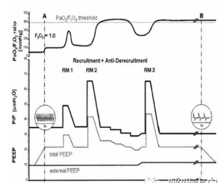 超实用临床干货 机械通气使用之呼吸机模式选择及参数设置 2