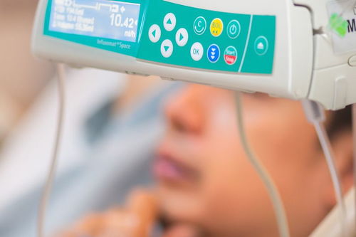 瑞思迈S9 Auto25与VPAP ST呼吸机对比 哪款更适合ST模式需求？